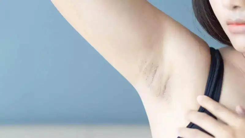 5 Ways to get rid of black underarms