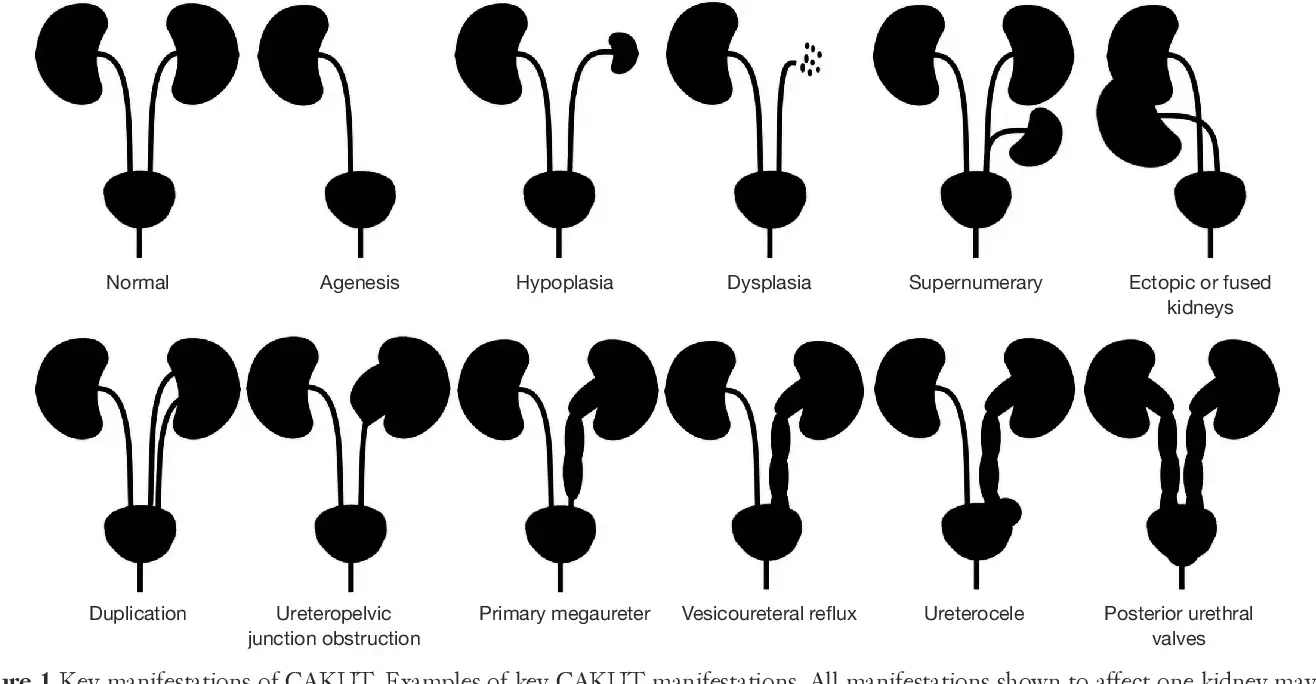 Congenital abnormalities