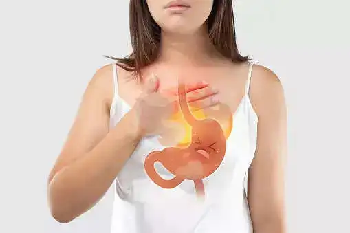 acid reflux